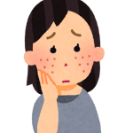 それって本当にニキビ？繰り返す脂漏性皮膚炎はニゾラールクリームで治す