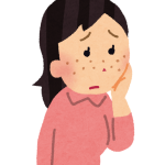 メラライトフォートクリームの美白効果は本物？シミ・そばかす・火傷跡の色素沈着を治す期待の成分とは