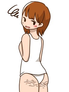 セルライトは下半身が痩せるように食生活を改善すると予防できる！